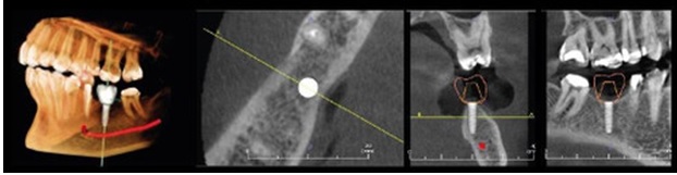 CBCT machine 