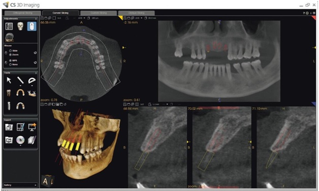 CBCT machine 